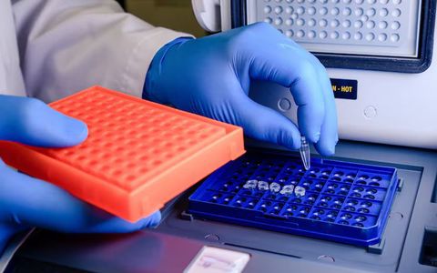 TNF Alpha ELISA Kit Guide: Applications and Detection