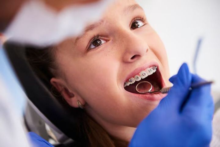 Teeth Braces Options: A Complete Guide to Modern Orthodontic Treatments