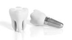 Zirconia Dental Implants Guide: Discover Benefits, Types, and Important Information