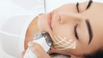 Non Surgical Face Sculpting Overview: What to Expect Before and After Treatment