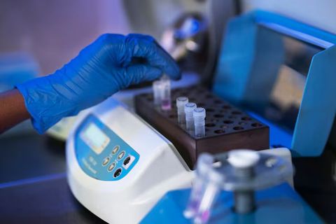 Learn About PCR Machines: Knowledge, Strategies, and Advanced Tips