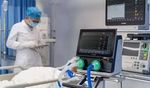 ICU Ventilator Manufacturing Guide: Essential Processes and Industry Knowledge