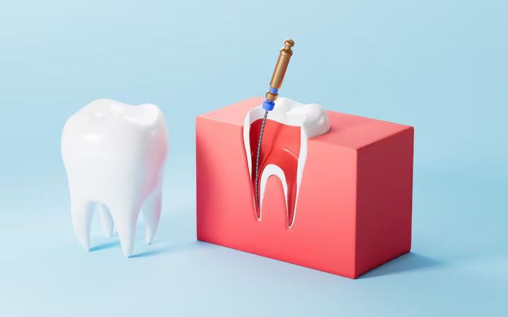 A Beginner’s Guide to Root Canal Treatment: What Patients Should Know