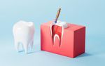 A Beginner’s Guide to Root Canal Treatment: What Patients Should Know