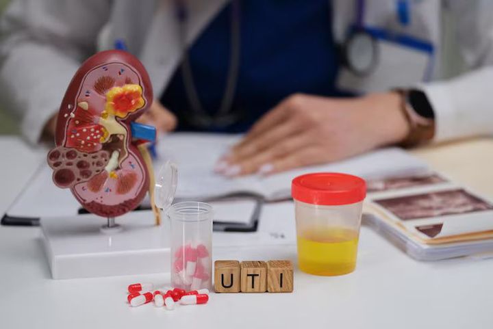 Kidney Stones Causes & Prevention: Essential Tips for Healthy Kidneys