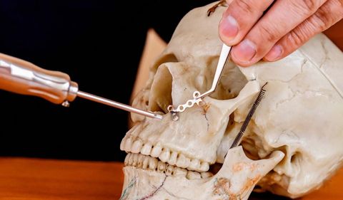 Maxillofacial Implant Manufacturing Basics: Learn How Modern Implants Are Created